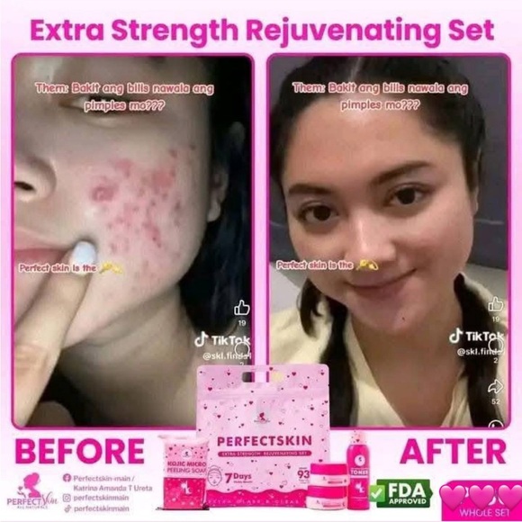💓Perfect Skin Rejuv set💓 - Picture 3 of 8
